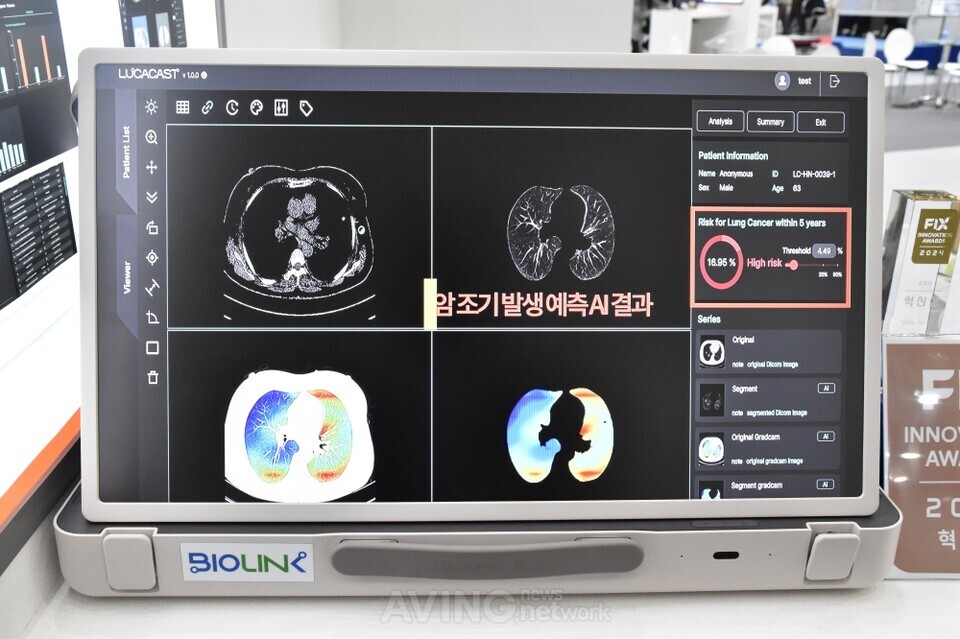 Biolink introduces AI lung cancer prediction software LucaCast at FIX ...